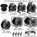 Schill Deployable Reel Options